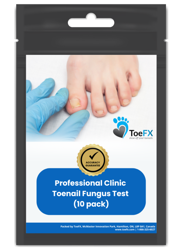Professional Clinic PCR Fungus Test - 10 packs + free shipping