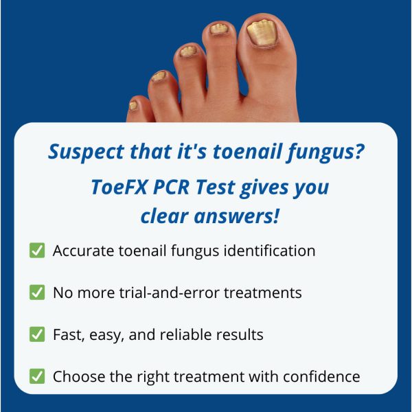 Professional Clinic PCR Fungus Test - 10 packs + free shipping - Image 5