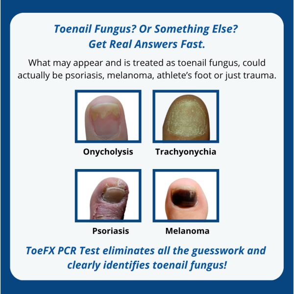 Professional Clinic PCR Fungus Test - 10 packs + free shipping - Image 3