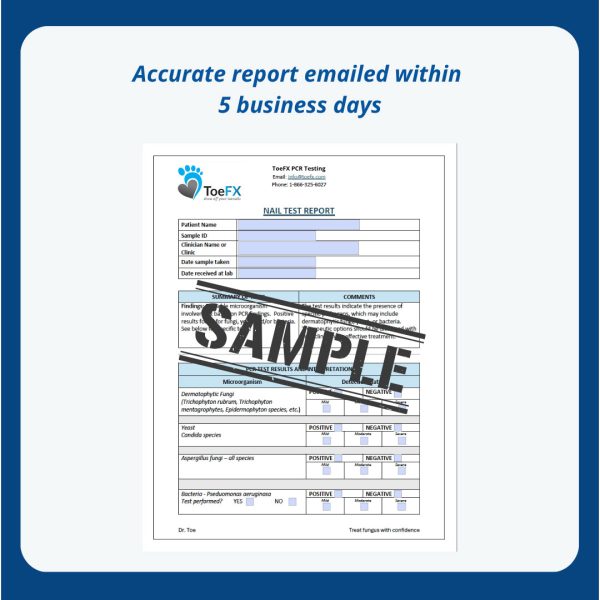 Professional Clinic PCR Fungus Test - 10 packs + free shipping - Image 4